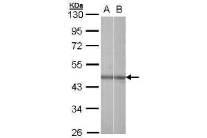 WB Image Sample (30 ug of whole cell lysate) A: Hela B: Raji 10% SDS PAGE antibody diluted at 1:1000 (NR2F6 antibody  (C-Term))