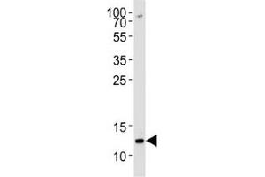 Western blot analysis of lysate from K562 cell line using H4 antibody diluted at 1:1000 for each lane.