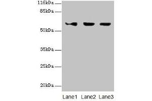 Western blot All lanes: ATL3 antibody at 2 μg/mL Lane 1: Jurkat whole cell lysate Lane 2: Hela whole cell lysate Lane 3: HepG2 whole cell lysate Secondary Goat polyclonal to rabbit IgG at 1/10000 dilution Predicted band size: 61 kDa Observed band size: 61 kDa (ATL3 antibody  (AA 1-187))