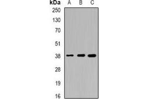 Western blot analysis of Sorbitol Dehydrogenase expression in HT29 (A), mouse liver (B), mouse kidney (C) whole cell lysates.