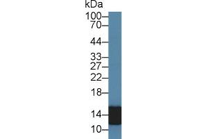 Detection of S100A8 in Human Leukocyte lysate using Polyclonal Antibody to S100 Calcium Binding Protein A8 (S100A8) (S100A8 antibody  (AA 1-89))