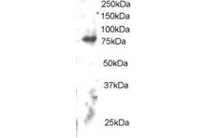 Western Blotting (WB) image for anti-Engulfment and Cell Motility 2 (ELMO2) (C-Term) antibody (ABIN2465647) (ELMO2 antibody  (C-Term))