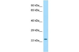 WB Suggested Anti-RAB30 Antibody Titration: 1. (RAB30 antibody  (C-Term))