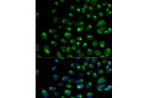 Immunofluorescence analysis of U2OS cells using IFNAR2 Polyclonal Antibody (IFNAR2 antibody)