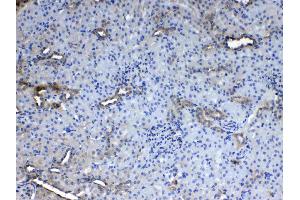 IHC analysis of CD151 using anti- CD151 antibody . (CD151 antibody  (AA 113-175))