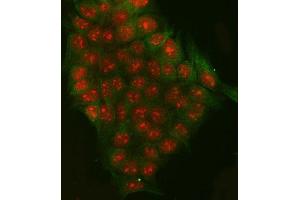 IF analysis of RRP7A and Tubulin beta using anti-RRP7A antibody (ABIN7599044) and anti-Tubulin beta antibody (ABIN7602744). (RRP7A antibody  (AA 1-181))
