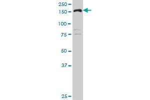 CLTC polyclonal antibody (A01), Lot # O51130JC01 Western Blot analysis of CLTC expression in MES-SA/Dx5 . (Clathrin Heavy Chain (CLTC) (AA 232-340) antibody)