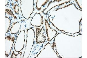 Immunohistochemical staining of paraffin-embedded Human pancreas tissue using anti-BDH2 mouse monoclonal antibody. (BDH2 antibody)