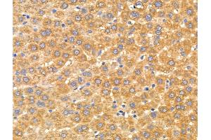 ABIN6256912 and ABIN6274865 at 1/100 staining Rat liver tissue by IHC-P.