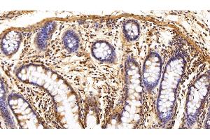 Detection of TXNIP in Human Colon Tissue using Polyclonal Antibody to Thioredoxin-interacting Protein (TXNIP) (TXNIP antibody  (AA 32-367))