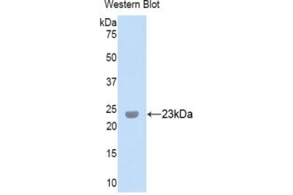 Peroxidasin antibody  (AA 1285-1475)