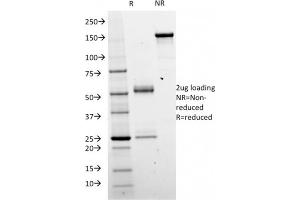 SDS-PAGE Analysis Purified Catenin beta Mouse Monoclonal Antibody (CTNNB1/2098). (CTNNB1 antibody)