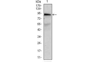 Western blot analysis using ABCB5 antibody against A431 (1) cell lysate. (ABCB5 antibody  (AA 481-674))