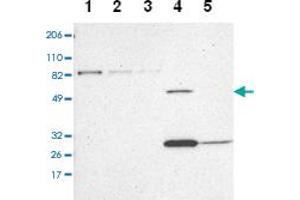 Western blot analysis of Lane 1: RT-4, Lane 2: U-251 MG, Lane 3: A-431, Lane 4: Liver, Lane 5: Tonsil with ZNF75A polyclonal antibody at 1:100-1:250 dilution. (ZNF75A antibody)