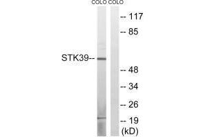 Western blot analysis of extracts from COLO cells, using STK39 (Ab-311) antibody. (STK39 antibody  (Ser311))