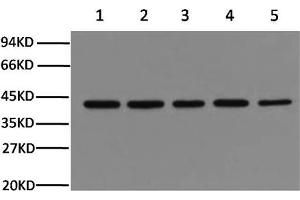 Western Blotting (WB) image for anti-Actin, beta (ACTB) antibody (ABIN5958070) (beta Actin antibody)