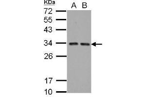 WB Image Sample (30 ug of whole cell lysate) A: A431 B: HeLa 12% SDS PAGE antibody diluted at 1:5000 (HIV-1 Tat Interactive Protein 2, 30kDa (HTATIP2) antibody)