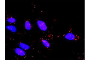 Proximity Ligation Analysis of protein-protein interactions between MAP2K3 and TAOK2. (TAO Kinase 2 antibody  (AA 831-930))