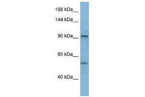ATP2A1 antibody used at 1 ug/ml to detect target protein. (ATP2A1/SERCA1 antibody  (N-Term))