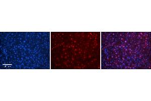 Rabbit Anti-TBX10 Antibody      Formalin Fixed Paraffin Embedded Tissue: Human Adult Liver   Observed Staining: Nuclear in hepatocytes, strong signal, wide tissue distribution  Primary Antibody Concentration: 1:100  Secondary Antibody: Donkey anti-Rabbit-Cy3  Secondary Antibody Concentration: 1:200  Magnification: 20X  Exposure Time: 0. (T-Box 10 antibody  (N-Term))