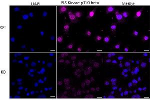 Immunocytochemical staining of HT- cells using PI3 Kinase p110 beta antibody (ABIN7799817), 1:1,000), Top panel: wild-type (WT), Bottom panal: PI3 Kinase p110 beta shRNA knockdown (KD). (Recombinant PIK3CB antibody)