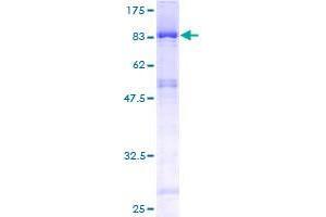 Image no. 1 for Enhancer of mRNA Decapping 3 (EDC3) (AA 1-508) protein (GST tag) (ABIN1352306) (EDC3 Protein (AA 1-508) (GST tag))