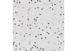 Immunohistochemistry of paraffin-embedded mouse brain using PRP19 Rabbit mAb (ABIN7269505) at dilution of 1:100 (40x lens). (PRP19 antibody)