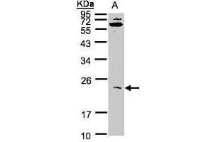 WB Image Sample(30 ug whole cell lysate) A:293T 12% SDS PAGE antibody diluted at 1:1000 (UBE2M antibody)