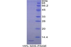 SDS-PAGE analysis of Human Selenoprotein W1 Protein.