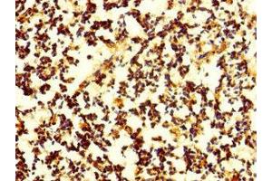 Immunohistochemistry of paraffin-embedded human appendix tissue using ABIN7165176 at dilution of 1:100 (CNPY4 antibody  (AA 22-248))