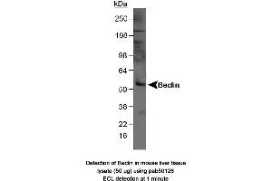 Image no. 1 for anti-Beclin 1, Autophagy Related (BECN1) antibody (ABIN363435) (Beclin 1 antibody)