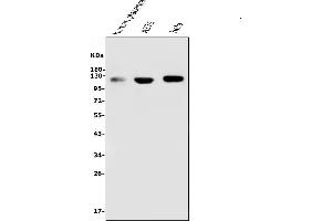 Western blot analysis of CD146 using anti-CD146 antibody (ABIN7602097).