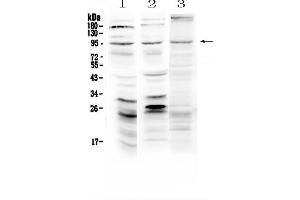 Western blot analysis of Semaphorin 3A using anti-Semaphorin 3A antibody .