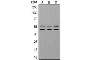 Western blot analysis of GSK3 alpha/beta (pY279/216) expression in A549 insulin-treated (A), NIH3T3 insulin-treated (B) whole cell lysates. (GSK3 alpha/beta antibody  (pTyr216, pTyr279))