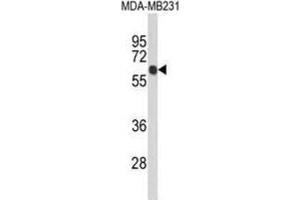 Western Blotting (WB) image for anti-Ankyrin Repeat Domain 13C (ANKRD13C) antibody (ABIN5024534)