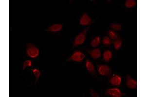 Immunofluorescence (fixed cells) (IF/ICC) image for anti-Nuclear Factor of kappa Light Polypeptide Gene Enhancer in B-Cells Inhibitor, alpha (NFKBIA) (pSer32), (pSer36) antibody (ABIN6256292)