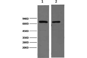 Western Blotting (WB) image for anti-Heat Shock Protein 70 (HSP70) antibody (ABIN5956903) (HSP70 antibody)