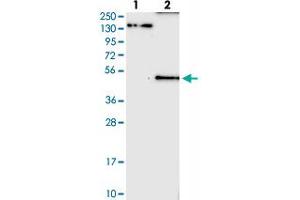 Western blot analysis of Lane 1: Negative control (vector only transfected HEK293T lysate), Lane 2: Over-expression Lysate (Co-expressed with a C-terminal myc-DDK tag (~3. (KCNJ5 antibody)