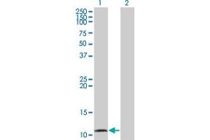 Western Blot analysis of CCL15 expression in transfected 293T cell line by CCL15 monoclonal antibody (M01), clone 1D7.