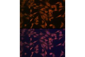 Immunofluorescence analysis of C6 cells using CENPC Rabbit mAb (ABIN7266273) at dilution of 1:100 (40x lens). (Centromere Protein C Pseudogene 1 (CENPCP1) antibody)