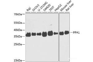 Western blot analysis of extracts of various cell lines using PPA1 Polyclonal Antibody at dilution of 1:1000. (Pyrophosphatase (Inorganic) 1 (PPA1) antibody)