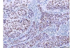 IHC analysis of MSH2 using anti-MSH2 antibody (ABIN7601369).