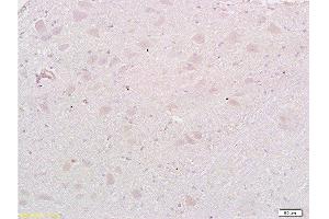 Formalin-fixed and paraffin embedded: rat brain tissue labeled with Anti-MAP1A Polyclonal Antibody , Unconjugated at 1:200, followed by conjugation to the secondary antibody and DAB staining (MAP1A antibody  (AA 2651-2750))