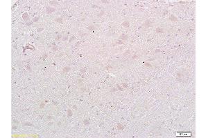 Formalin-fixed and paraffin embedded: rat brain tissue labeled with Anti-MAP1A Polyclonal Antibody , Unconjugated at 1:200, followed by conjugation to the secondary antibody and DAB staining