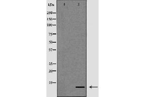 Western blot analysis of K562 cell lysate, using S100A12 Antibody.