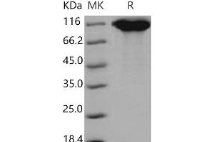 Western Blotting (WB) image for Leukemia Inhibitory Factor Receptor alpha (LIFR) (Active) protein (His tag) (ABIN7320281) (LIFR Protein (His tag))