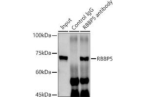 Immunoprecipitation analysis of 300 μg extracts of MCF7 cells using 3 μg RBBP5 antibody (ABIN6128620, ABIN6146741, ABIN6146742 and ABIN6222719).