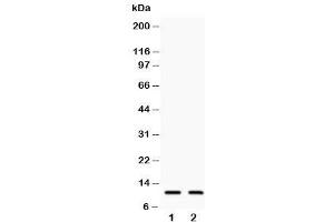 Western blot testing of Eotaxin 3 antibody and Lane 1:  COLO320 (CCL26 antibody  (C-Term))