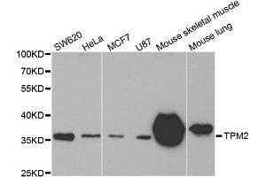 Western Blotting (WB) image for anti-Tropomyosin-2 (TPM2) antibody (ABIN1875181) (TPM2 antibody)
