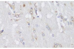 Immunohistochemistry of paraffin-embedded Rat brain using FA2H Polyclonal Antibody at dilution of 1:150 (40x lens).
